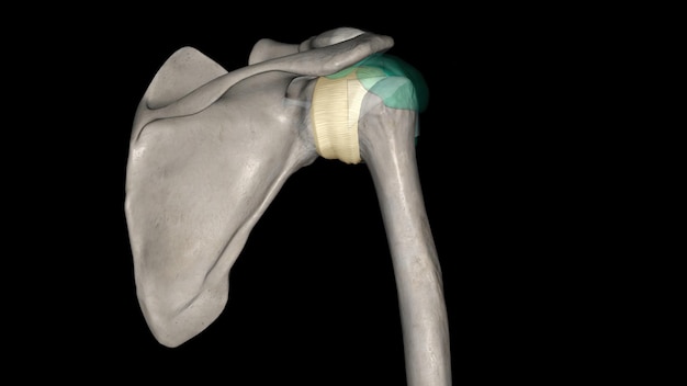 Photo joint capsule of the glenohumeral joint