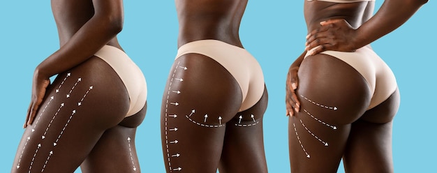 Jonge afro-amerikaanse vrouwen in beige lingerie met perfecte huid met lijnen voor lichaamsvorming of drainagemassage