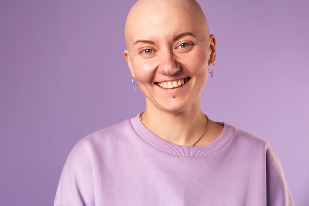 Jonge vrouw die aan kanker lijdt, lacht glimlach, voelt zich positief over toekomstig herstel Duizendjarige vrouw met geschoren hoofd