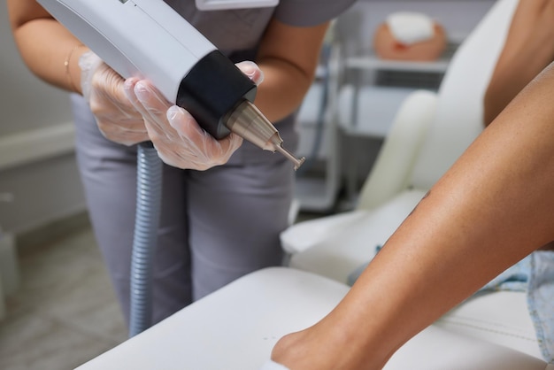Jonge vrouw die een laser-tatoeageverwijderingsprocedure ondergaat in de salonclose-up