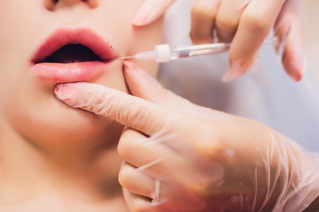 Jonge vrouw krijgt een injectie in haar lippen in schoonheidssalon. schoonheid injecties - vrouw liggend in het kantoor van de schoonheidsspecialiste. lippen verhogen door hyaluronzuur, contourprocedure, revitalisatie