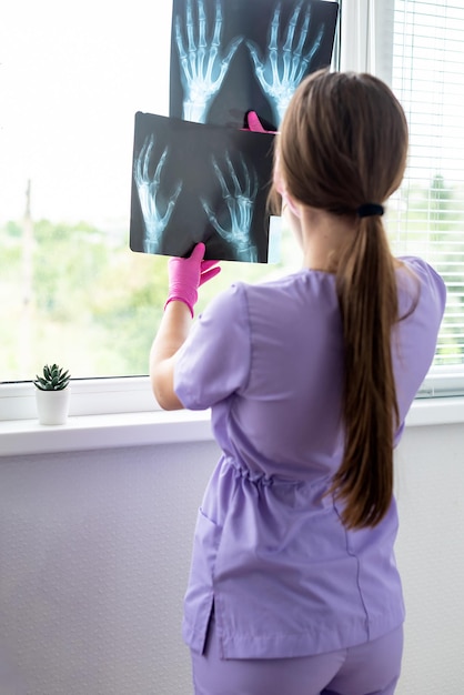 Jonge vrouwelijke arts kijkt naar röntgenfoto's in de kliniek arts chirurg die de scan van de botten van de patiënt bekijkt screening testresultaat medische controle gezondheidszorg radiologie concept