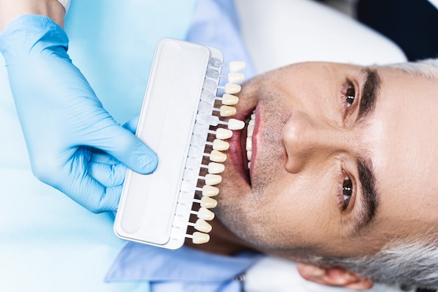 Joyful male is lying in chair while dentist is helping him with choosing colour before whitening