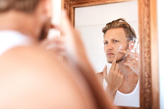 Just when I thought I was pimplefree Shot of a young man examining his skin in the mirror at home