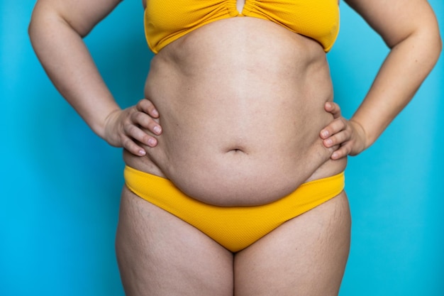 Keep hands on woman flabby sagging belly closeup fat hips\
obesity and cellulite naked overweight plus size girl on blue\
background in yellow underwear concept of dieting and lose\
weight