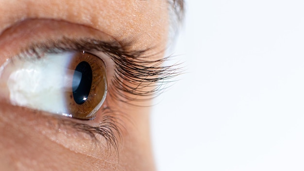 Keratoconus eye disease