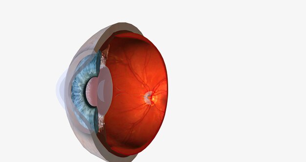 Keratoconus is an eye disease that affects the structure of the cornea