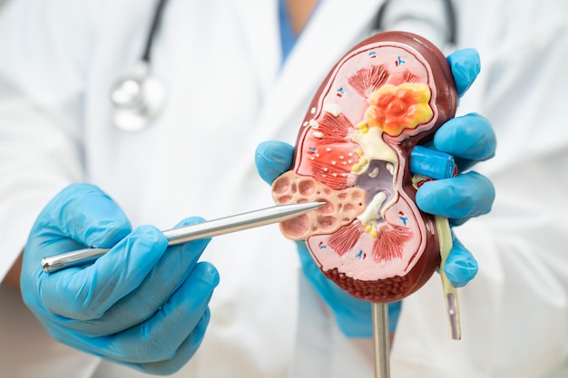 kidney disease chronic kidney disease ckd doctor hold human model to treat and study in hospital
