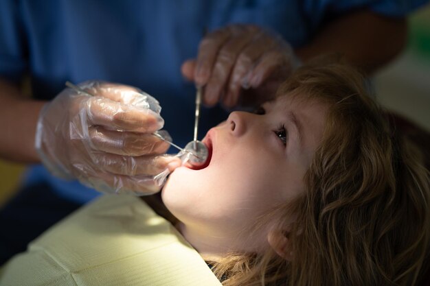 Kids stomatology and teeth care concept Dentist checking little child patient teeth up at dental clinic Closeup of little boy opening his mouth wide during inspection of oral cavity