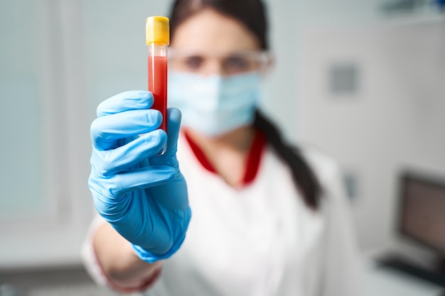 Kind young woman standing in her cabinet while demonstrating glass test tube with blood sample