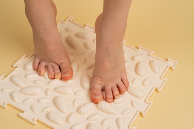 Kindervoeten op een beige orthopedisch tapijt op een beige achtergrond behandeling en preventie van platvoeten hallux valgus