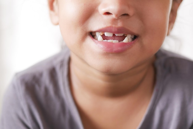 Kindmeisje glimlachend met misvormde tanden
