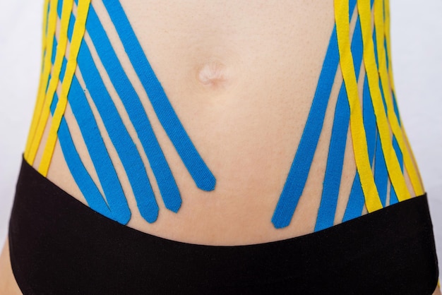 Kinesio tape on the abdomen of a young woman