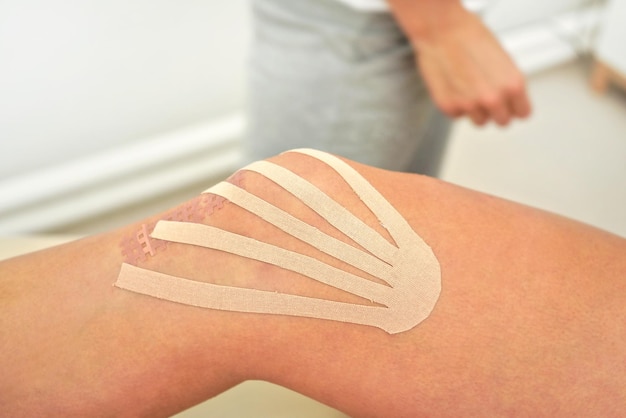 Kinesiology tape in body color cut to thin stripes applied to knee of female patient, closeup detail.