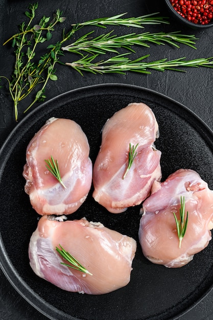 Kipfilet filet zonder vel. Gevogelte van de boerderij. Zwarte achtergrond. Bovenaanzicht