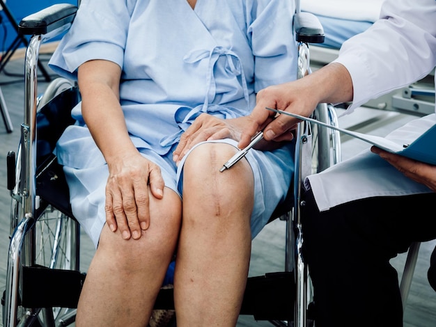 Knee surgery scar Closeup scars surgical total knee joint replacement on senior or elderly old lady woman patient on wheelchair pointing by pen while doctor holding patient medical record file