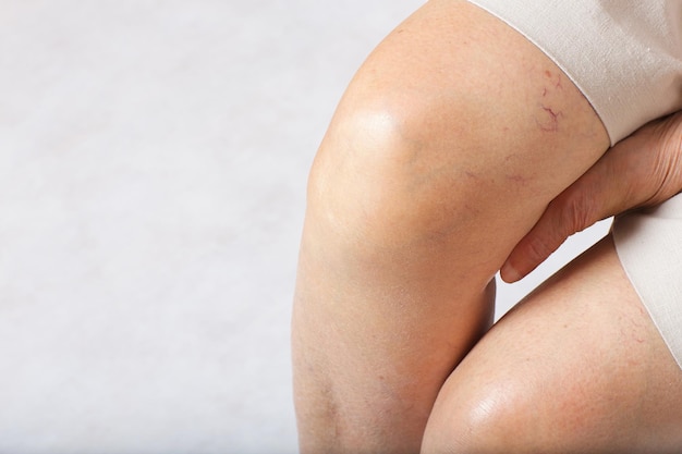 Photo knees of senior woman between 70 and 80 years old.closeup