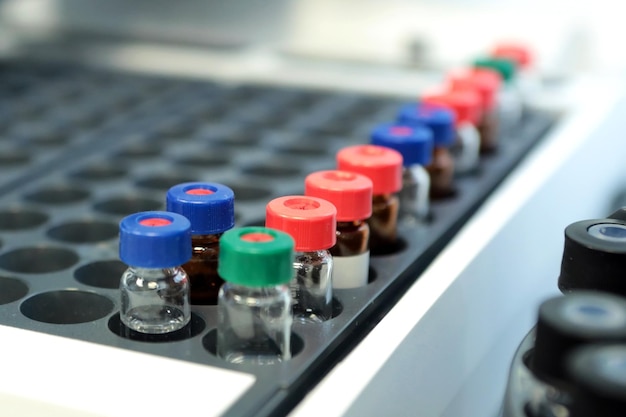 Foto kwaliteitscontrole laboratoriumgeneeskunde chromatograafwerking flessencontrole op de kwaliteit van de suspensie