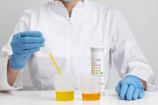 Foto medico di laboratorio che esegue esame medico delle urine