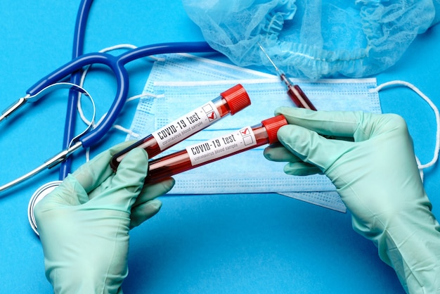 Assistente tecnico di laboratorio o medico che tiene un campione di sangue in provetta al laboratorio