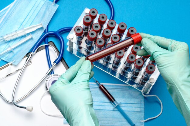 lab technician assistant or doctor holding a blood sample in test tube