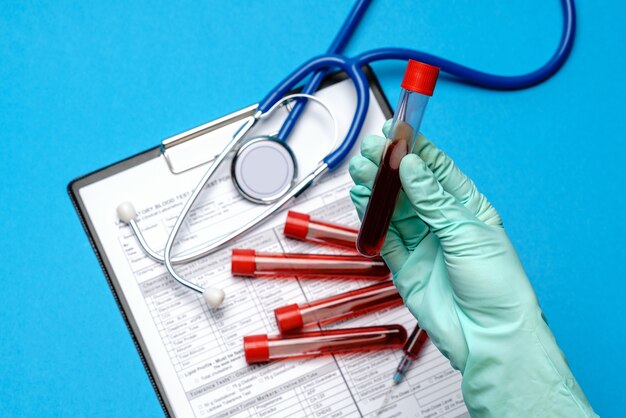 Lab technician assistant or doctor wearing rubber or latex gloves holding blood test tube over clipboard with blank form.