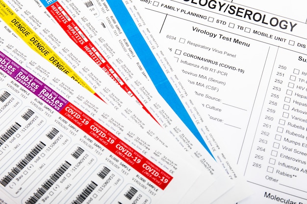 Lab virus blood test concept