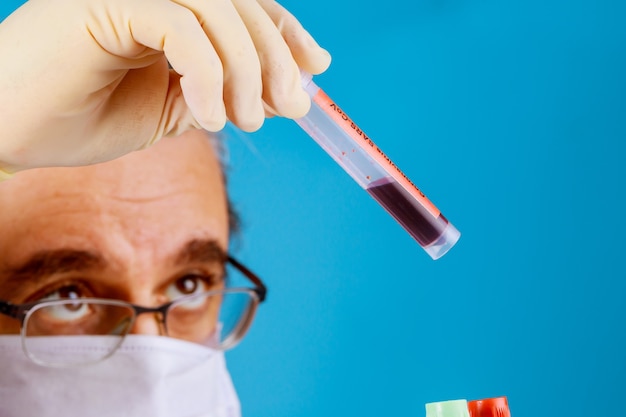 Laboratoriumtechnicus een hand houden met bloedbuis testmonster