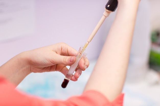 Laboratory assistant in medical laboratory holds test tube with blood and plasma in his hand and doing analysis.