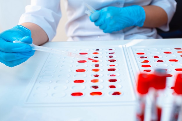 Laboratory determination of blood type. Blood test