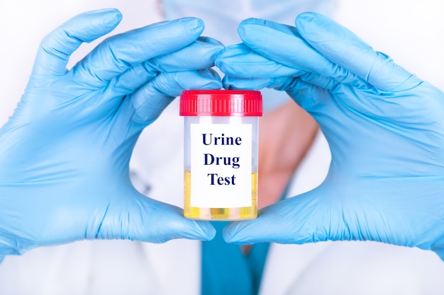Foto campione di laboratorio di urina per farmaci o test di sostanze
