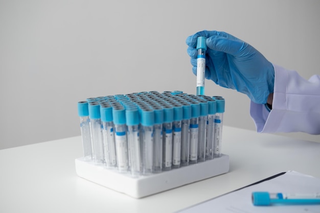 Laboratory scientist or medical researcher working at lab with tubes analyzing the sample of the test