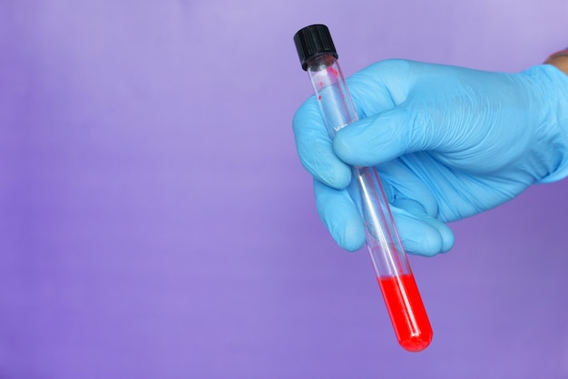 Laboratory technician hand holding blood test tube