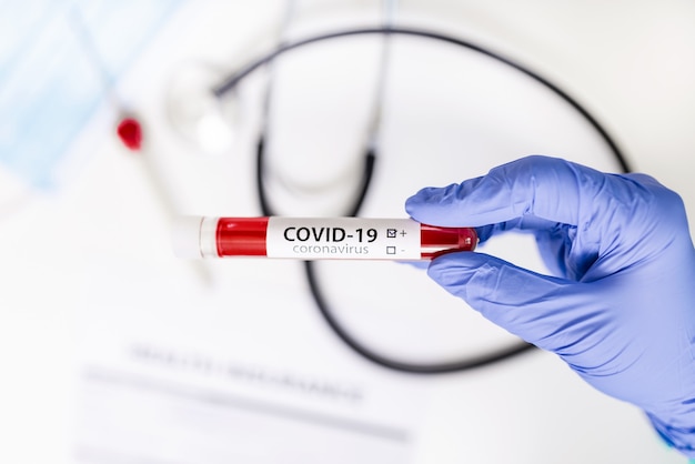 Лаборант держит пробирку для анализа на вирус короны, тест COVID 19