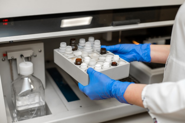 사진 실험실 기술자는 자동 혈액 샘플 분석기에서 혈액을 테스트합니다.