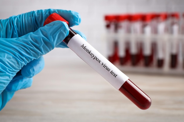 Laboratory worker holding test tube with blood sample at wooden table closeup