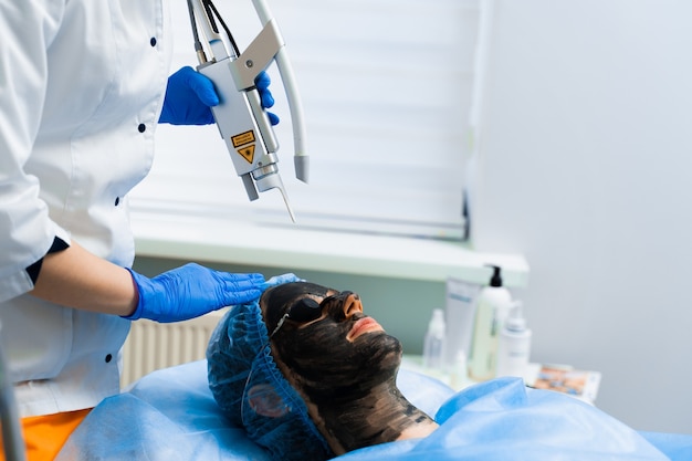 Laserfotoverjonging en carbon peeling van het gezicht voor vrouwen. zwart gezichtsmasker. dermatologie en cosmetologie. met behulp van chirurgische laser.