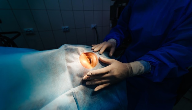 Laserzichtcorrectie Een patiënt en een chirurg in de operatiekamer tijdens oogchirurgie Gesloten oog Patiënt onder steriele hoes Close-up