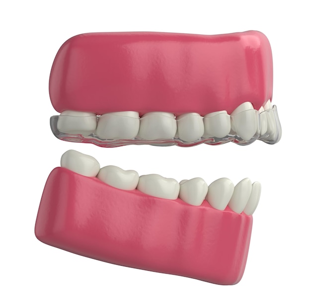 Photo lateral view of teeth with invisible orthodontics 3d illustration