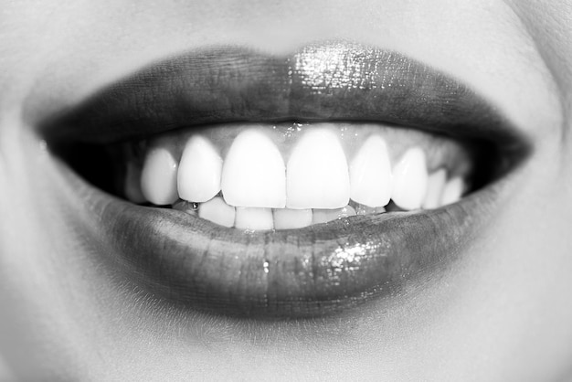 Laughing woman mouth with great teeth Perfect smile after bleaching Dental care and whitening teeth Healthy smile smaling