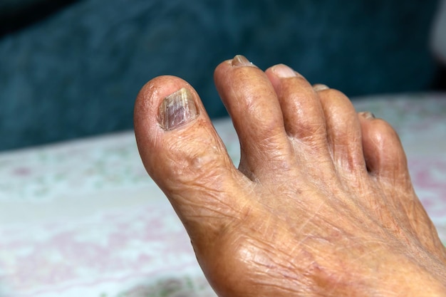 leg of the elderly person to check for symptoms of illnesshealth care concept