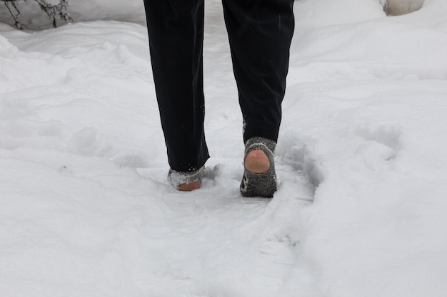 雪の中で破れた靴下の足