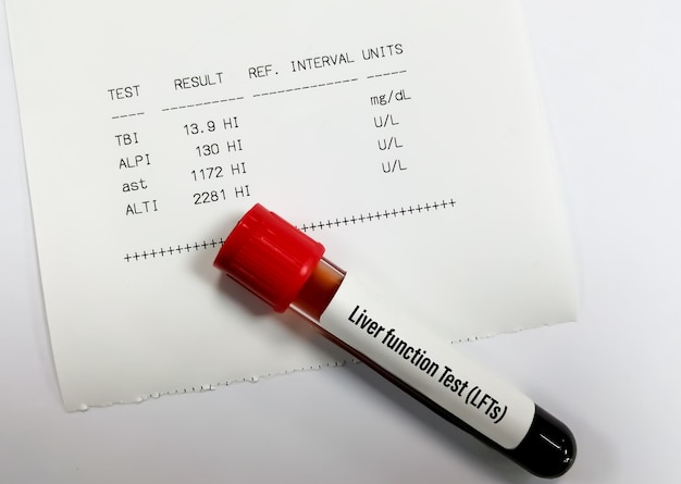 Foto leverfunctietest inclusief alt ast alp en totaal bilirubine met abnormaal patiëntrapport
