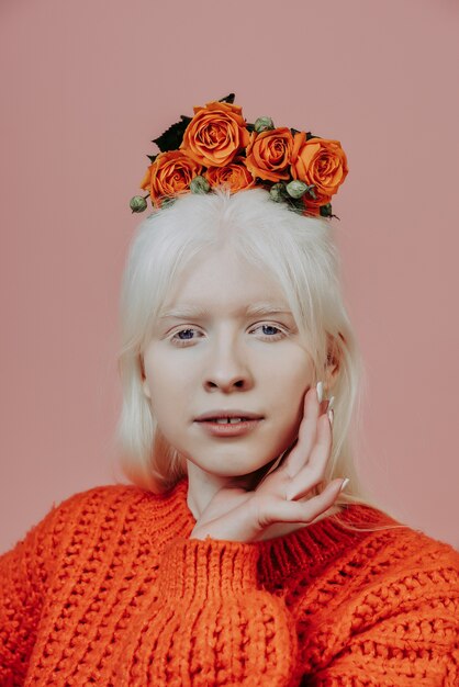 Lifestyle image of an albino girl posing in studio. Concept about body positivity, diversity, and fashion