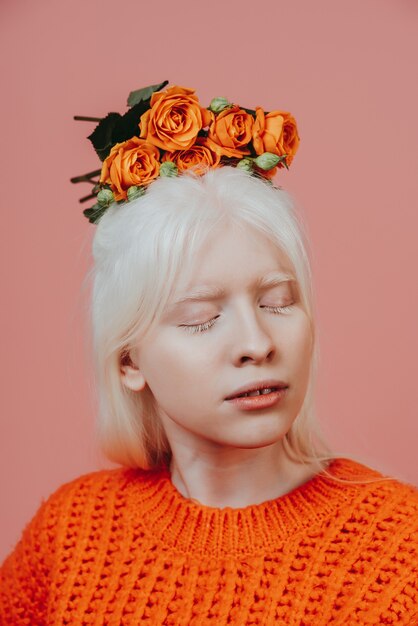 Образ жизни девушки-альбиноса, позирующей в студии. Понятие о бодипозитиве, разнообразии и моде