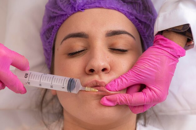 Aumento delle labbra bocca della bella giovane donna che riceve l'iniezione di acido ialuronico primo piano delle mani dell'estetista che fanno la procedura di bellezza per il trattamento di cosmetologia delle labbra femminili sexy ad alta risoluzione