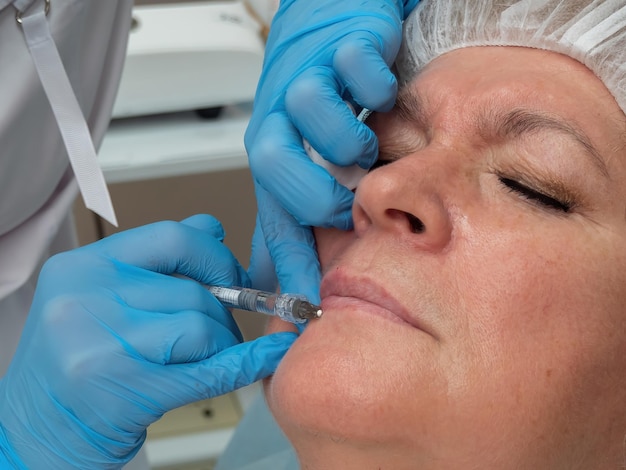 Foto aumento delle labbra correzione delle labbra preparazione dell'acido ialuronico età donna caucasica messa a fuoco selettiva