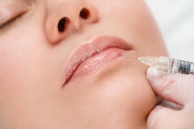 Procedura di correzione della forma delle labbra in un salone di cosmetologia lo specialista esegue un'iniezione sulle labbra del paziente aumento delle labbra