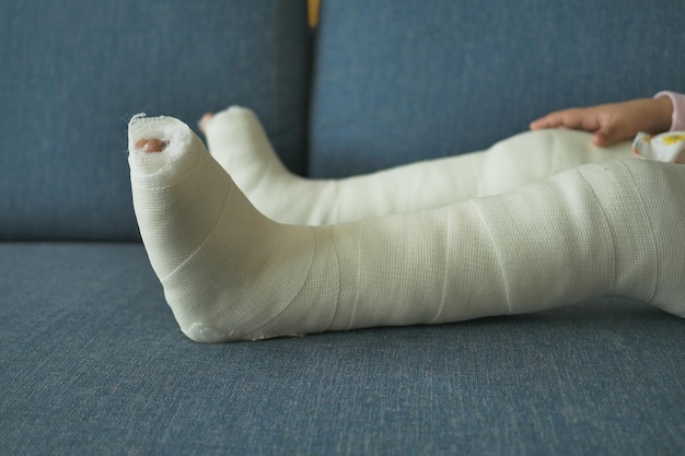 little child with plaster bandage on leg