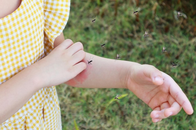 Photo little girl has skin rash allergy and itchy on her arm from mosquito bite